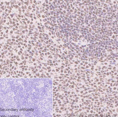 Immunohistochemistry (Formalin/PFA-fixed paraffin-embedded sections) - Anti-ARID1A antibody [EPR13501-73] (AB182561)