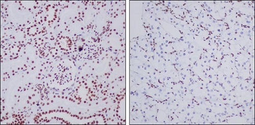 Immunohistochemistry (Formalin/PFA-fixed paraffin-embedded sections) - Anti-ARID1A antibody [EPR13501-73] (AB182561), expandable thumbnail