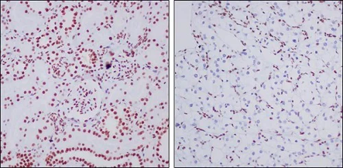 Immunohistochemistry (Formalin/PFA-fixed paraffin-embedded sections) - Anti-ARID1A antibody [EPR13501-73] (AB182561)