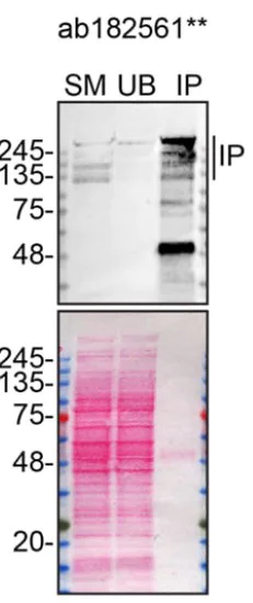 Immunoprecipitation - Anti-ARID1A antibody [EPR13501-73] (AB182561)
