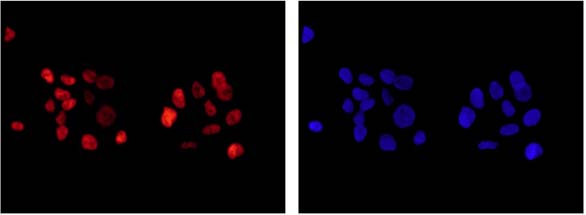 Immunocytochemistry/ Immunofluorescence - Anti-ARID1A antibody [EPR13501] (AB182560), expandable thumbnail