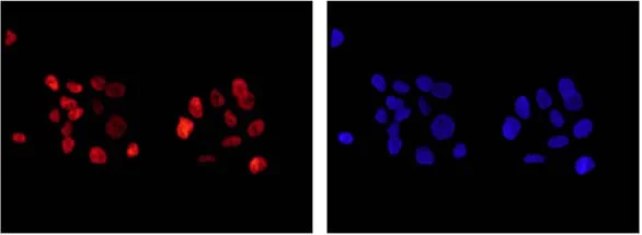 Immunocytochemistry/ Immunofluorescence - Anti-ARID1A antibody [EPR13501] (AB182560)