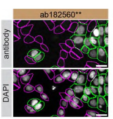 Immunocytochemistry/ Immunofluorescence - Anti-ARID1A antibody [EPR13501] (AB182560)