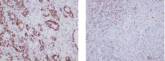 Immunohistochemistry (Formalin/PFA-fixed paraffin-embedded sections) - Anti-ARID1A antibody [EPR13501] (ab182560), expandable thumbnail