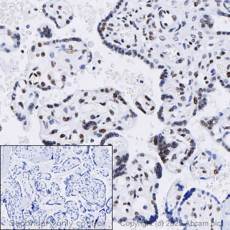 Immunohistochemistry (Formalin/PFA-fixed paraffin-embedded sections) - Anti-ARID1A antibody [EPR13501] (AB182560)