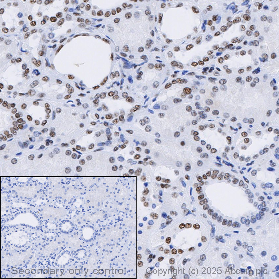Anti-ARID1A 抗体 [EPR13501] (ab182560) | Abcam