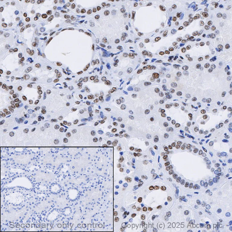 Immunohistochemistry (Formalin/PFA-fixed paraffin-embedded sections) - Anti-ARID1A antibody [EPR13501] (AB182560)