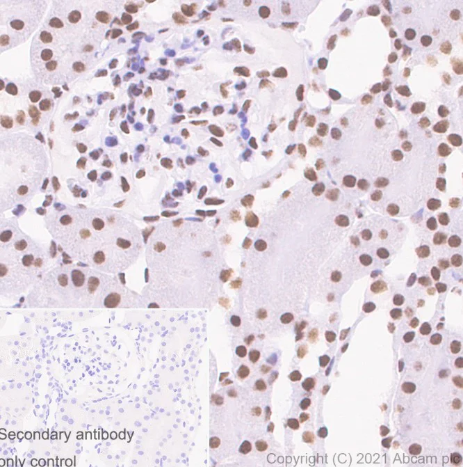 Immunohistochemistry (Formalin/PFA-fixed paraffin-embedded sections) - Anti-ARID1A antibody [EPR13501] (AB182560)