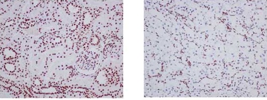 Immunohistochemistry (Formalin/PFA-fixed paraffin-embedded sections) - Anti-ARID1A antibody [EPR13501] (AB182560), expandable thumbnail