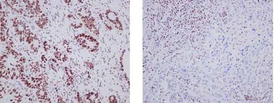 Immunohistochemistry (Formalin/PFA-fixed paraffin-embedded sections) - Anti-ARID1A antibody [EPR13501] - BSA and Azide free (AB217154)