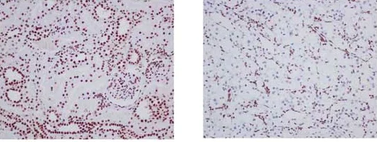 Immunohistochemistry (Formalin/PFA-fixed paraffin-embedded sections) - Anti-ARID1A antibody [EPR13501] - BSA and Azide free (AB217154)