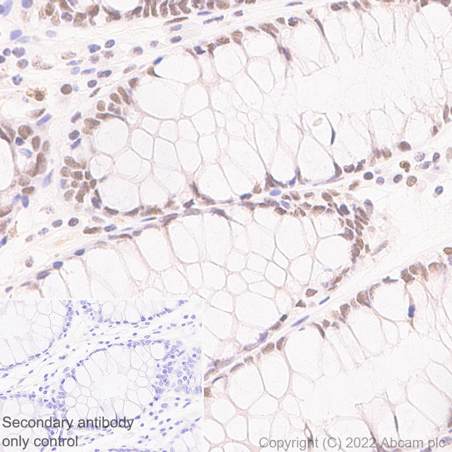 Immunohistochemistry (Formalin/PFA-fixed paraffin-embedded sections) - Anti-ARID1A antibody [EPR25407-17] (AB305172)