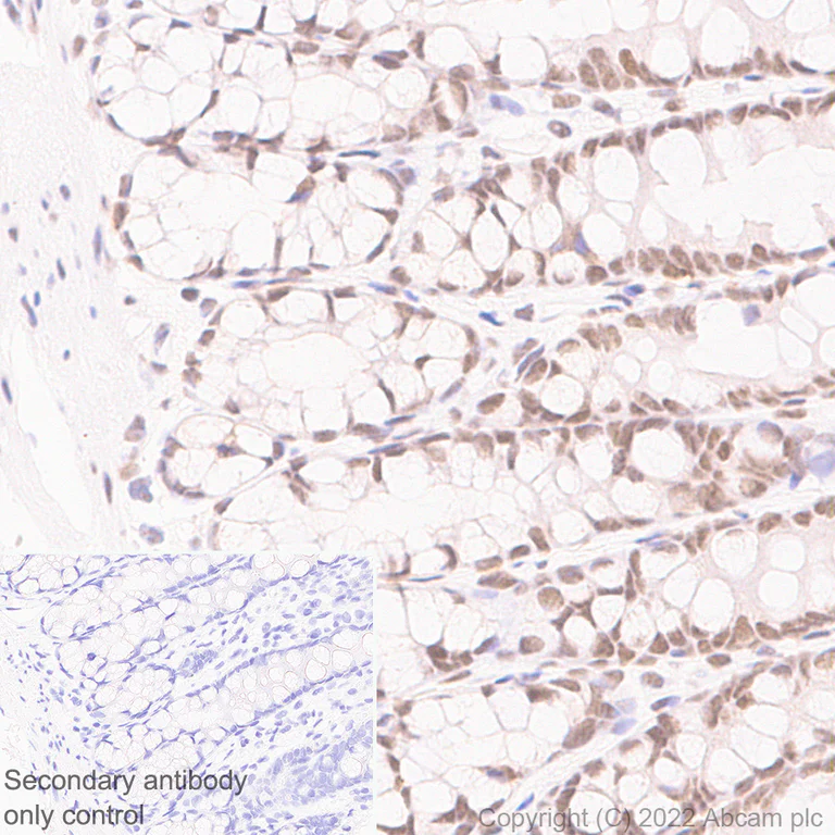 Immunohistochemistry (Formalin/PFA-fixed paraffin-embedded sections) - Anti-ARID1A antibody [EPR25407-17] (AB305172)