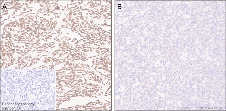 Immunohistochemistry (Formalin/PFA-fixed paraffin-embedded sections) - Anti-ARID1A antibody [EPR25407-17] (AB305172)