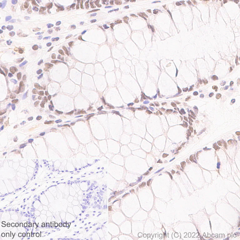Immunohistochemistry (Formalin/PFA-fixed paraffin-embedded sections) - Anti-ARID1A antibody [EPR25407-17] - BSA and Azide free (AB305173)