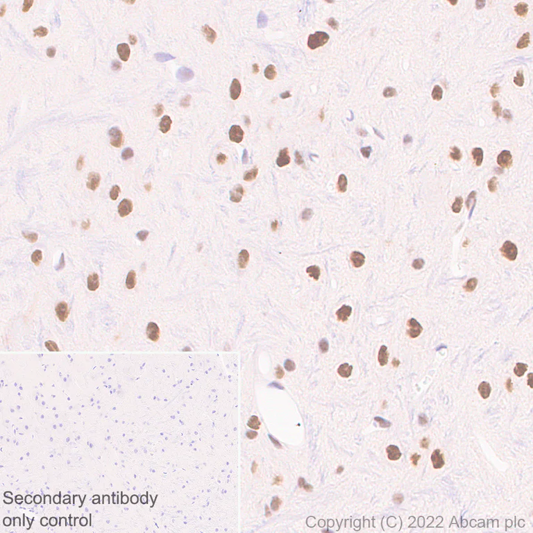 Immunohistochemistry (Formalin/PFA-fixed paraffin-embedded sections) - Anti-ARID1A antibody [EPR25407-17] - BSA and Azide free (AB305173)