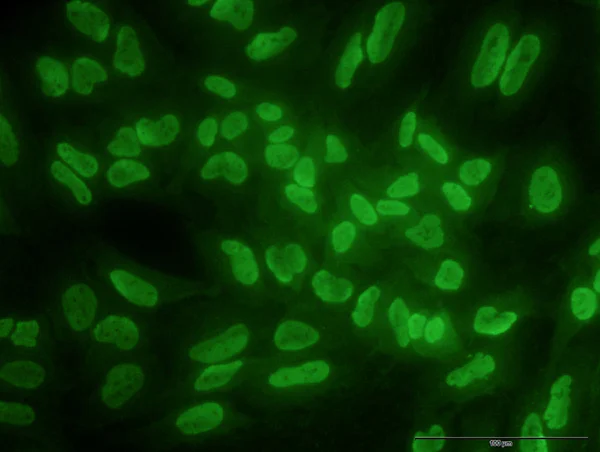 Immunocytochemistry/ Immunofluorescence - Anti-ARID1B antibody [2D2] (AB57461)