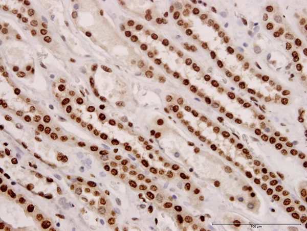 Immunohistochemistry (Formalin/PFA-fixed paraffin-embedded sections) - Anti-ARID1B antibody [2D2] (AB57461)