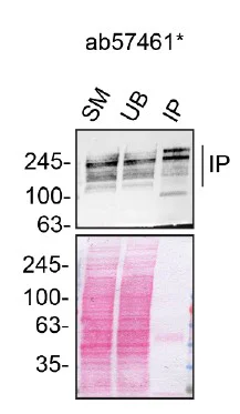 Immunoprecipitation - Anti-ARID1B antibody [2D2] (AB57461)