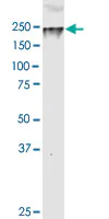 Western blot - Anti-ARID1B antibody [2D2] (AB57461)