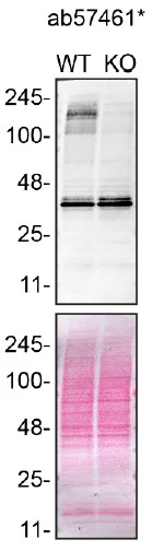 Western blot - Anti-ARID1B antibody [2D2] (AB57461)