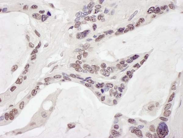 Immunohistochemistry (Formalin/PFA-fixed paraffin-embedded sections) - Anti-ARID1B antibody (AB245537), expandable thumbnail