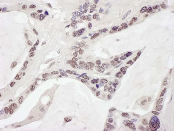Immunohistochemistry (Formalin/PFA-fixed paraffin-embedded sections) - Anti-ARID1B antibody (AB245537)