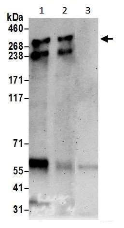 Immunoprecipitation - Anti-ARID1B antibody (AB245537), expandable thumbnail