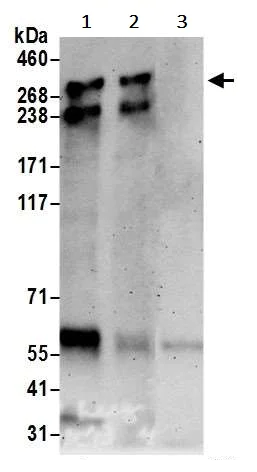 Immunoprecipitation - Anti-ARID1B antibody (AB245537)