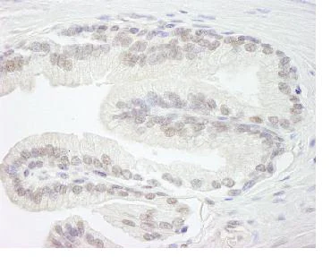 Immunohistochemistry (Formalin/PFA-fixed paraffin-embedded sections) - Anti-ARID1B antibody (AB84461)
