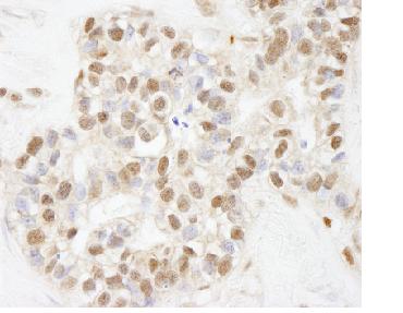 Immunohistochemistry (Formalin/PFA-fixed paraffin-embedded sections) - Anti-ARID1B antibody (AB84461)