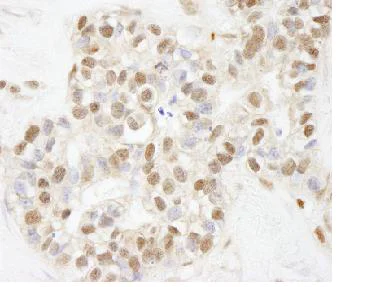 Immunohistochemistry (Formalin/PFA-fixed paraffin-embedded sections) - Anti-ARID1B antibody (AB84461)