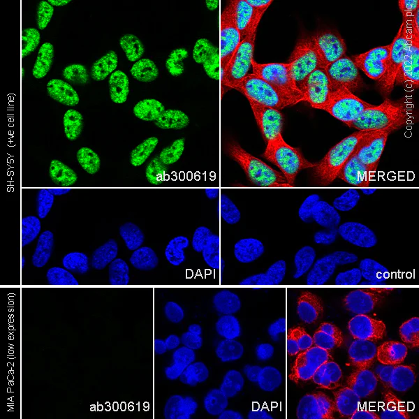 Immunocytochemistry/ Immunofluorescence - Anti-ARID1B antibody [EPR25408-34] (AB300619)