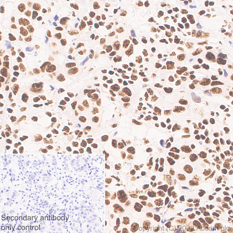 Immunohistochemistry (Formalin/PFA-fixed paraffin-embedded sections) - Anti-ARID1B antibody [EPR25408-34] (AB300619)