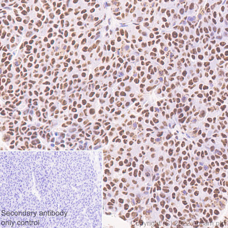 Immunohistochemistry (Formalin/PFA-fixed paraffin-embedded sections) - Anti-ARID1B antibody [EPR25408-34] (AB300619)