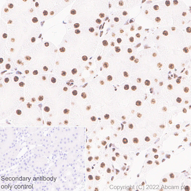 Immunohistochemistry (Formalin/PFA-fixed paraffin-embedded sections) - Anti-ARID1B antibody [EPR25408-34] (AB300619)