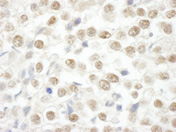 Immunohistochemistry (Formalin/PFA-fixed paraffin-embedded sections) - Anti-ARID2 antibody (AB113283)
