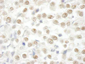 Immunohistochemistry (Formalin/PFA-fixed paraffin-embedded sections) - Anti-ARID2 antibody (AB113283)