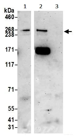 Immunoprecipitation - Anti-ARID2 antibody (AB245529)