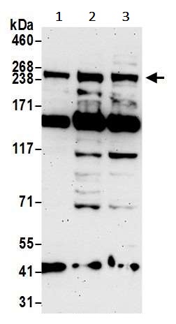 Western blot - Anti-ARID2 antibody (AB245529)
