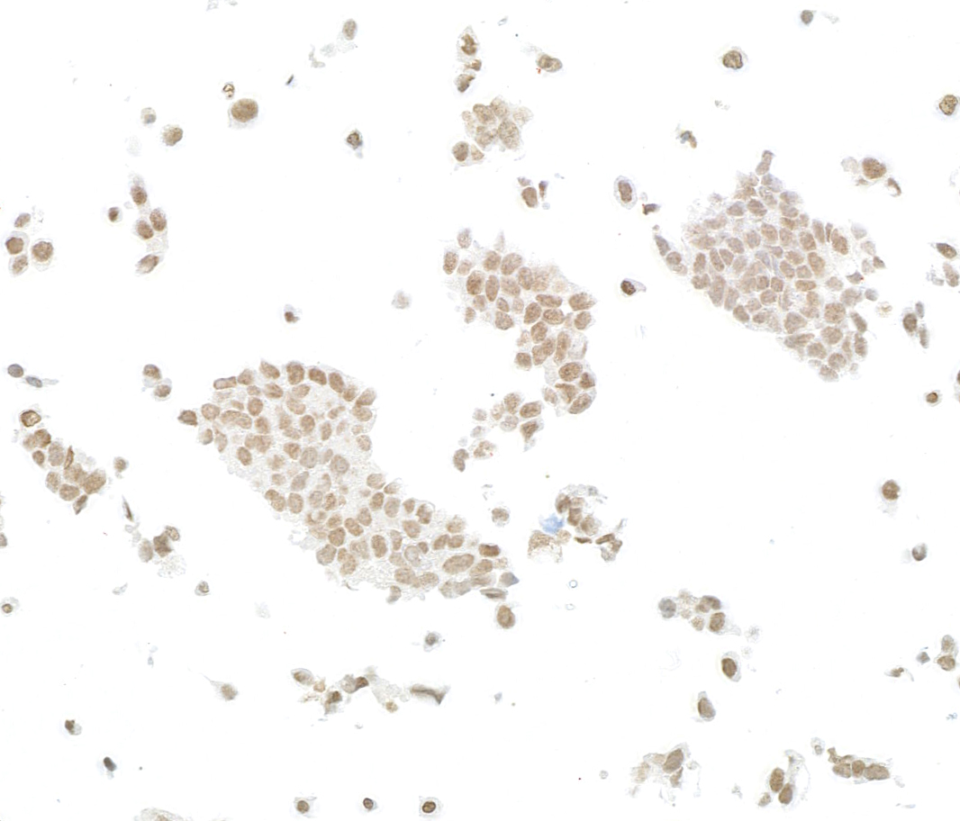Immunocytochemistry - Anti-ARID2 antibody [BLR213K] - BSA free (AB314046), expandable thumbnail