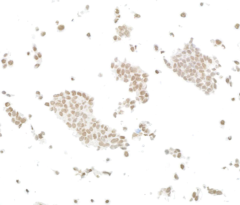 Immunocytochemistry - Anti-ARID2 antibody [BLR213K] - BSA free (AB314046)