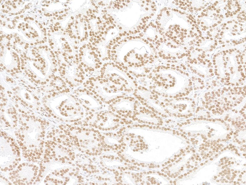 Immunohistochemistry (Formalin/PFA-fixed paraffin-embedded sections) - Anti-ARID2 antibody [BLR213K] - BSA free (AB314046), expandable thumbnail
