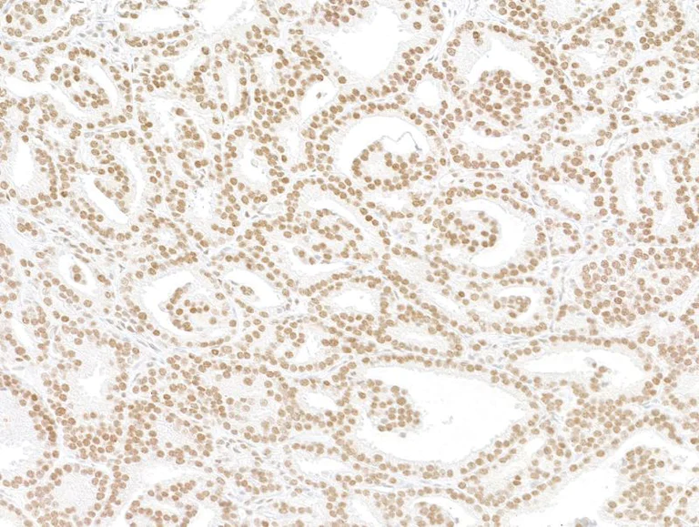 Immunohistochemistry (Formalin/PFA-fixed paraffin-embedded sections) - Anti-ARID2 antibody [BLR213K] - BSA free (AB314046)