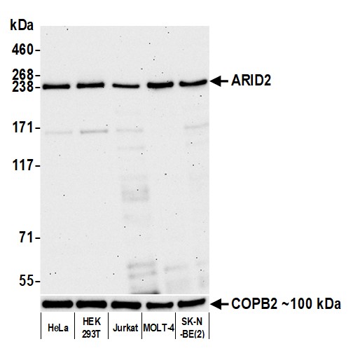 Western blot - Anti-ARID2 antibody [BLR213K] - BSA free (AB314046), expandable thumbnail