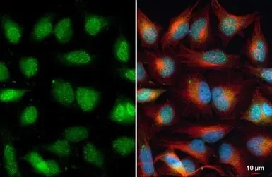 Immunocytochemistry/ Immunofluorescence - Anti-ARID5B antibody (AB226776)