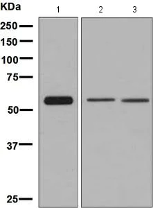 Western blot - Anti-ARIH2/TRIAD1 antibody [EPR7670] - BSA and Azide free (AB248635)