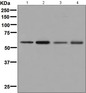Western blot - Anti-ARIH2/TRIAD1 antibody [EPR7671] (AB133653)