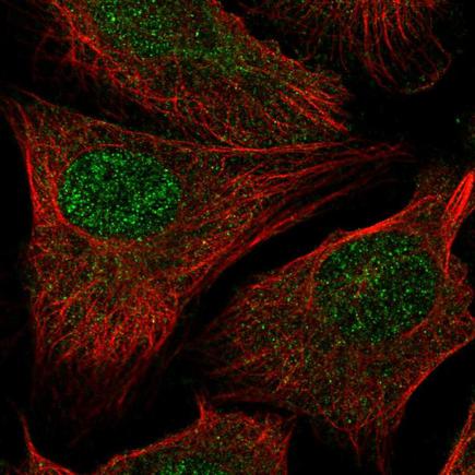 Immunocytochemistry/ Immunofluorescence - Anti-ARIP4 antibody (AB220238), expandable thumbnail