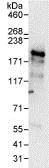 Immunoprecipitation - Anti-ARIP4 antibody (AB86063)